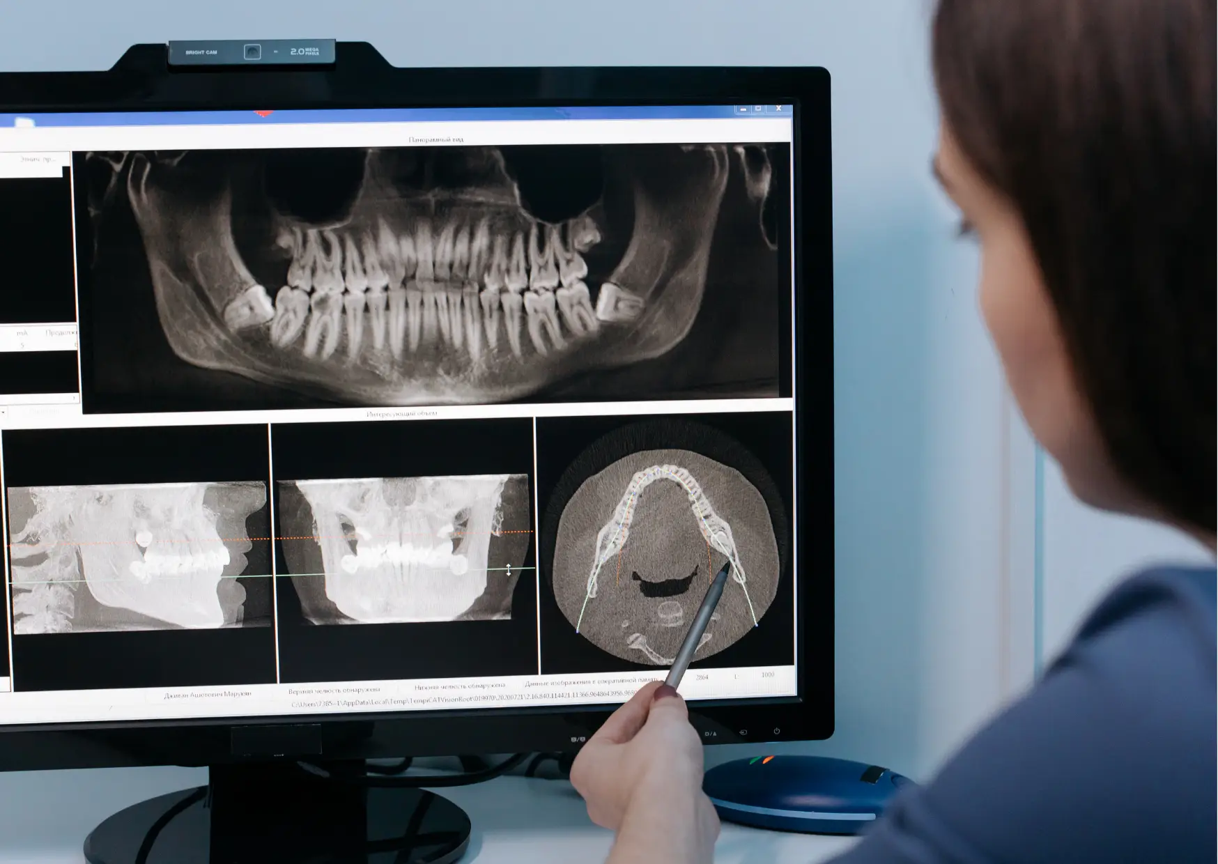 NHS grants NHS grants
